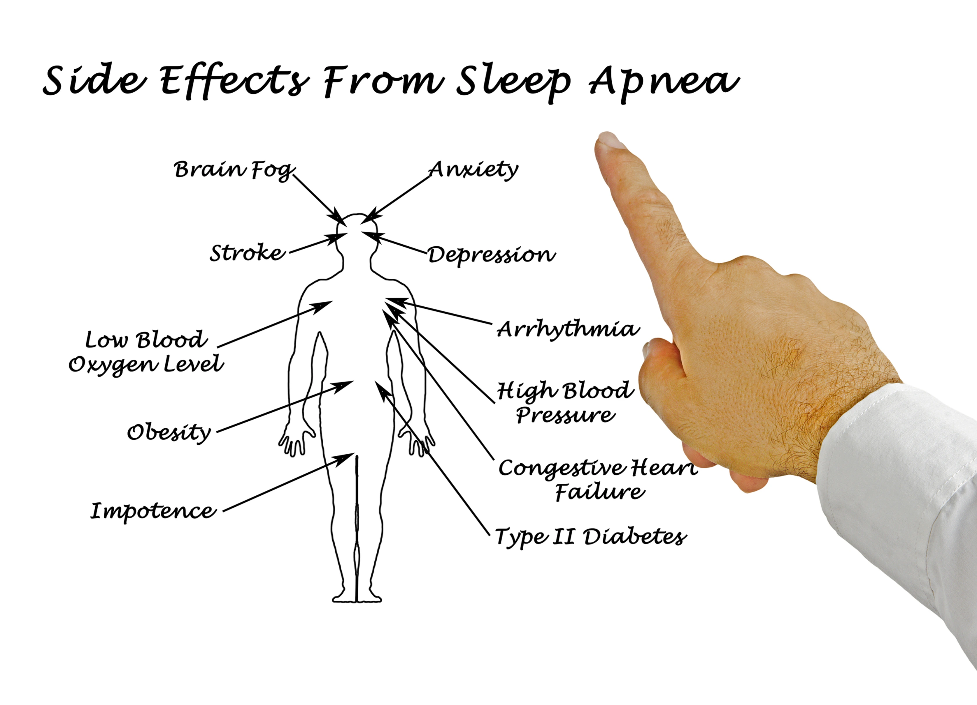 Side effects from untreated sleep disorders diagram